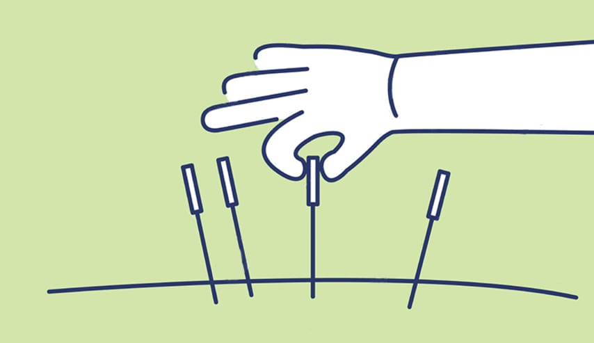 Auriculoterapia: regulación energética para tu bien estar