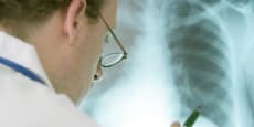 EPOC y enfermedades pulmonares, con el Dr. de Torres